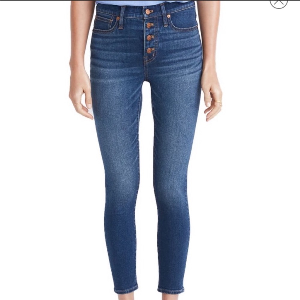 Madewell Button Front Crop Skinny Jeans 9”